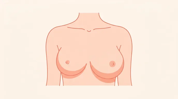 Illustration d'une poitrine asymétrique