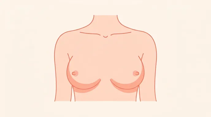 Illustration d'une poitrine écartée